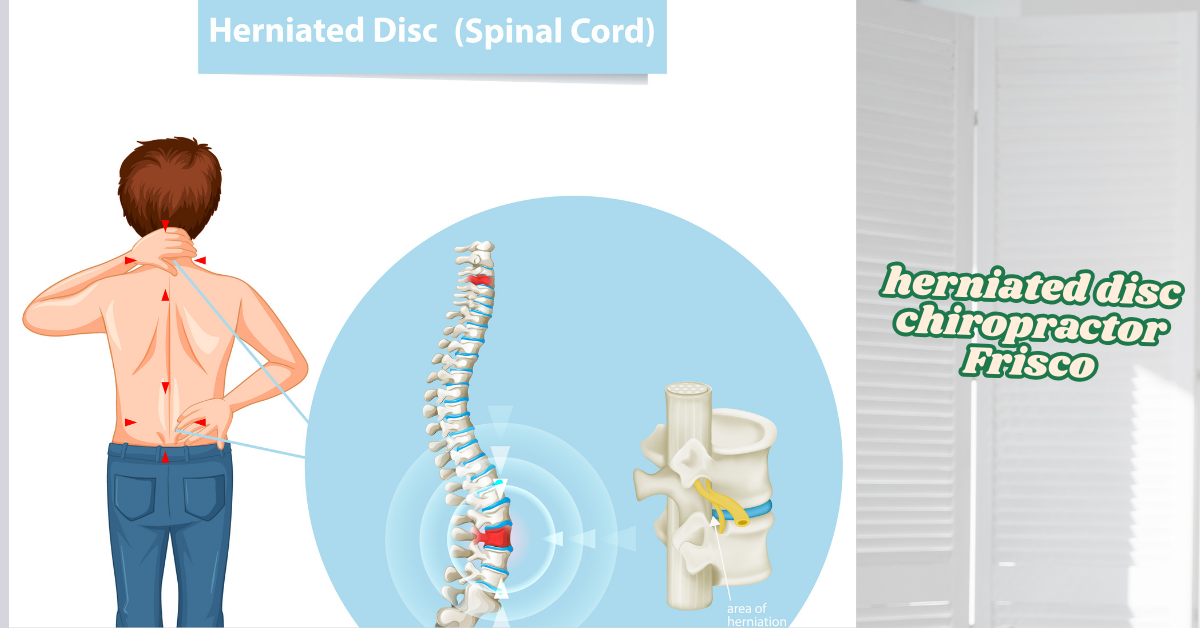 Can a chiropractor help a herniated disc